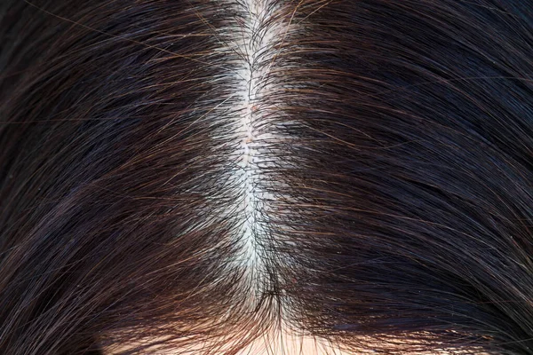 Gri Saçlı Kadın Kafası Yeniden Büyümüş Kökleri Yakından Görme Üst — Stok fotoğraf
