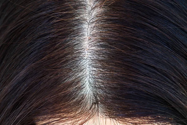 Testa Donna Con Capelli Grigi Vista Vicino Delle Radici Ricrescute — Foto Stock