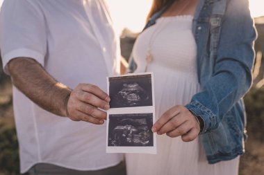 Hamile bir kadın ekografisine bakıyor..