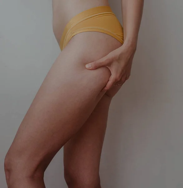 Hanches Femme Lingerie Jaune — Photo