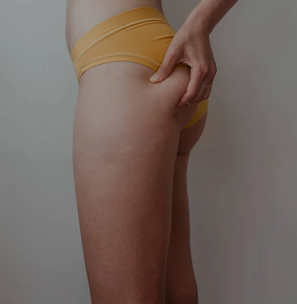 Mulher Quadris Lingerie Amarela — Fotografia de Stock