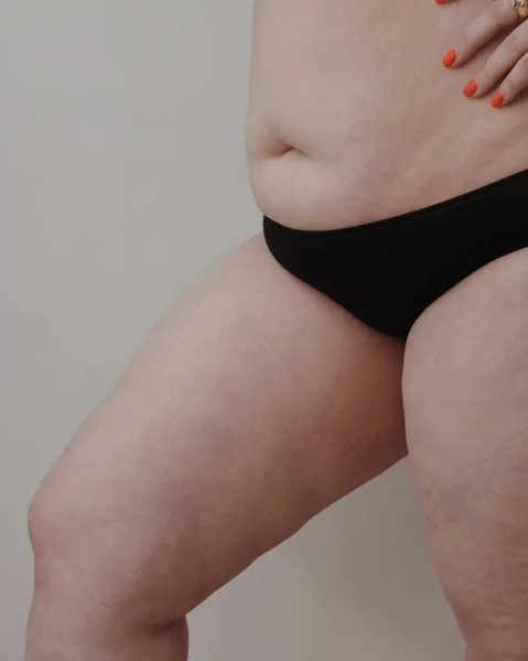 Caderas Mujer Sin Retoque —  Fotos de Stock