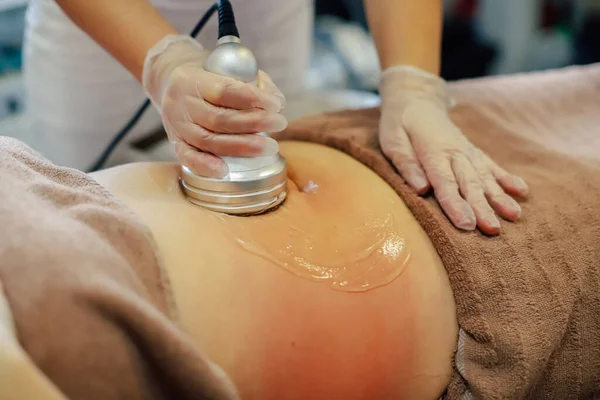 Mãos de uma pessoa que faz um procedimento de remoção de celulite no estômago das mulheres — Fotografia de Stock