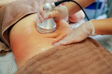 Kadınların midesinde selülit çıkarma işlemi yapan birinin elleri.