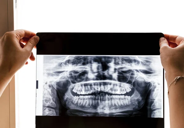 X-ray of a full set of teeth. X-ray concept.