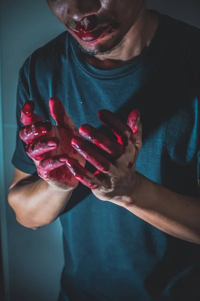 Skadad Man Med Blodig Hand — Stockfoto