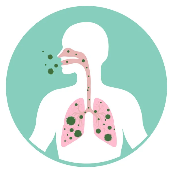 Icono Médico Los Seres Humanos Con Pulmones Enfermos Ilustración Plana — Vector de stock