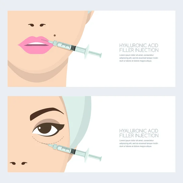 Inyección Facial Ácido Hialurónico Plantilla Diseño Banner Vectorial Labios Ojos — Vector de stock