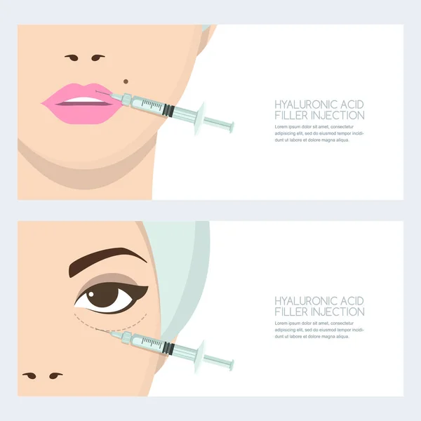 Hyaluronzuur Gezicht Injectie Vector Banner Ontwerp Template Lippen Ogen Periorbitale — Stockvector