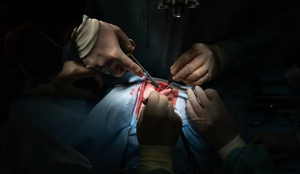Chirurgia estetica sul naso. Il chirurgo ricuce il paziente — Foto Stock
