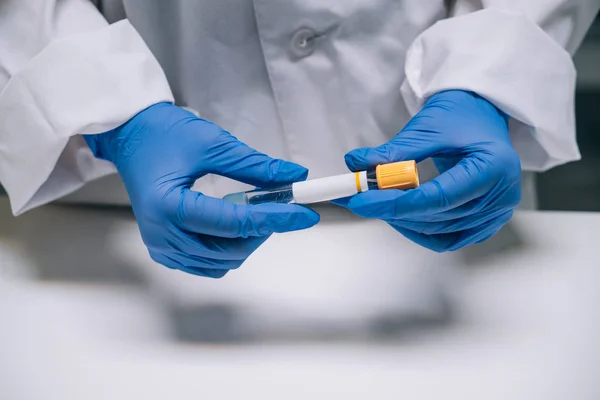 Investigadora médica o científica sostiene en las manos un tubo de ensayo —  Fotos de Stock