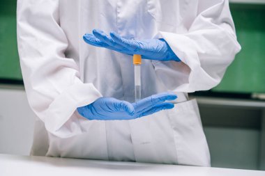 Kadın tıbbi ya da bilimsel araştırmacı elinde tüp bebek tutar.