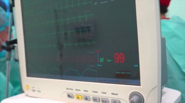 Dalgalar parlak parçası ile cardiomonitor.