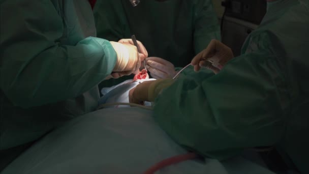 Surgeon and his assistant performing cosmetic surgery on nose — Stock Video