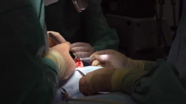 Cerrah ve burnuna estetik ameliyat asistanı