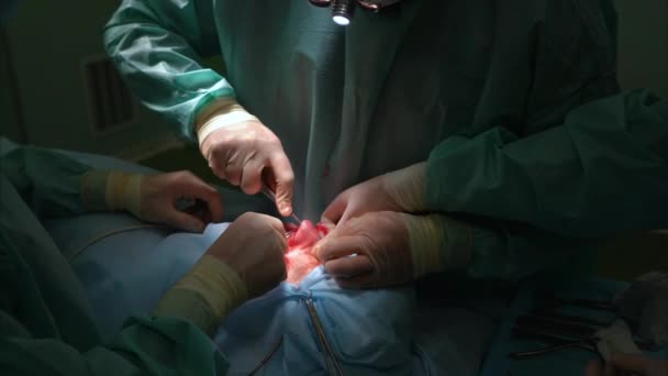 外科医生和他的助手在鼻子上执行整容手术 — 图库视频影像
