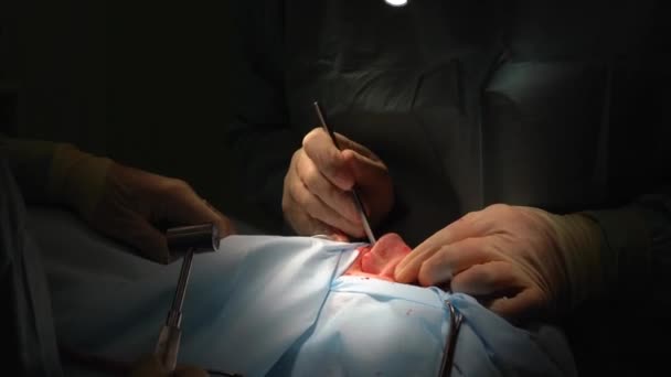 Chirurgien et son assistant effectuant une chirurgie esthétique du nez — Video