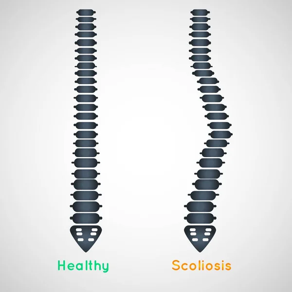 Diseño del icono del logotipo de escoliosis, ilustración del vector médico — Archivo Imágenes Vectoriales