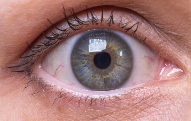 Bir kadının kırmızı gözü