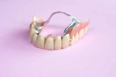 closeup of dental prosthesis on pink background clipart