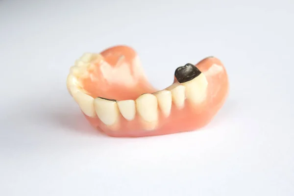 Closeup Dental Prosthesis White Background — Stock Photo, Image