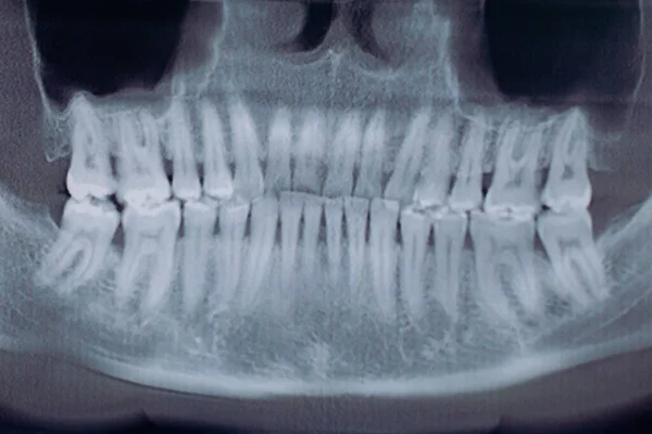 X線顎の正面図 概念医療 健康管理 — ストック写真