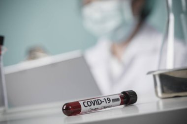 Laboratuvarda Coronavirus salgını (COVID-19) için hastaların kan örneklerinin test edilmesi, Wuhan Çin konseptinden Yeni Coronavirus 2019-nCoV