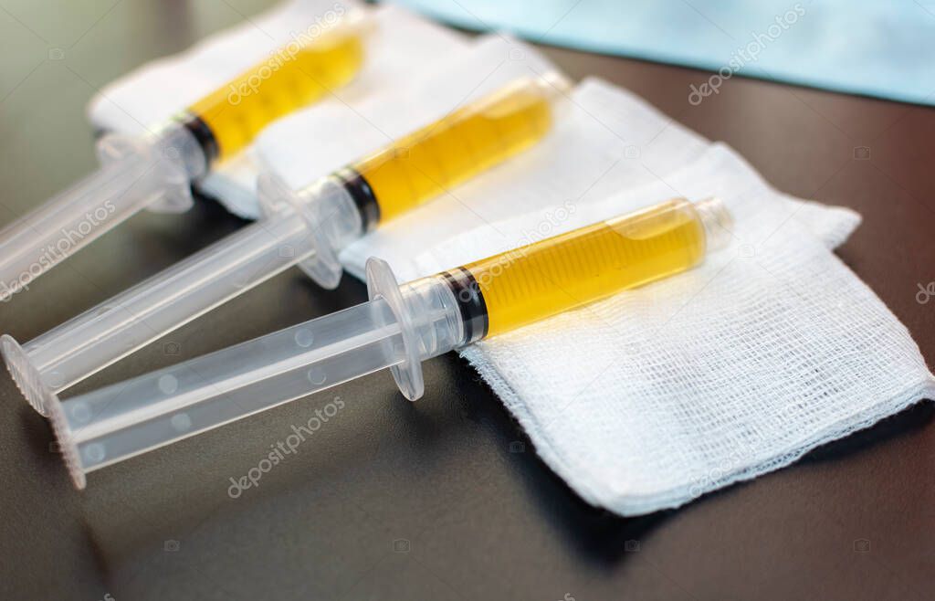 Blood plasma as a hope for treatment of coronavirus infection. Syringes with Platelet-Rich plasma preparation for plasmolifting therapy. Selective Focus.