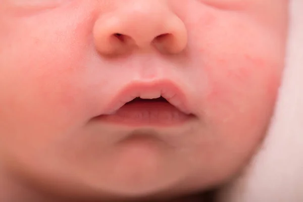 신생아의 입술을 닫으라 관리의 입술과 부드러운 초점을 가지고 있습니다 사진을 — 스톡 사진