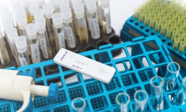 Covid-19 için hızlı test kaseti ve arka planda laboratuvar ekipmanları