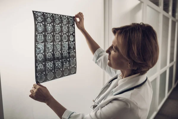 Neurocirujano Femenino Que Mira Exploración Roentgen Del Cerebro Primer Plano — Foto de Stock