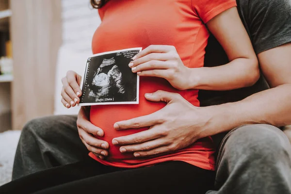 Results Ultrasound Happiness Love Each Other Home Sweet Sofa Motherhood — Stock Photo, Image