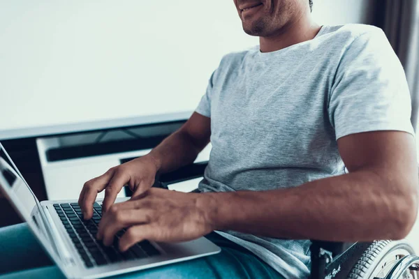 Disabled Man Holding Laptop Typing Lap Closeup Handsome Smiling Person — Stock Photo, Image