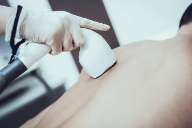 Spa Salon Lazer epilasyon için genç adam. Güzellik Salonu adam. Modern kozmetik. Profesyonel güzellik uzmanı. Doktor lazer epilatör ile. Erkek güzellik kavramı. Tıbbi donatımı.