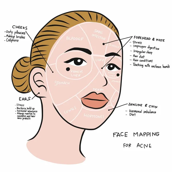 Mapeo Facial Para Acné Hermosa Ilustración Del Vector Facial Mujer — Vector de stock
