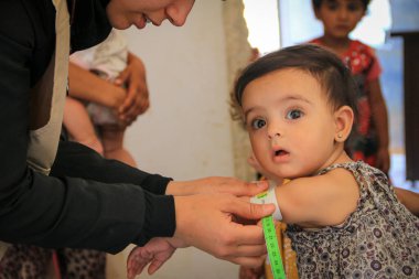 Halep, Suriye 27 Eylül 2019: Genç çocuklar hastanede tedavi ediliyor.