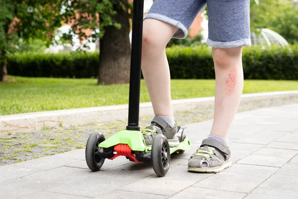 Üç tekerli scooter 'dan yaralanan erkek bacakları, yakın çekim.