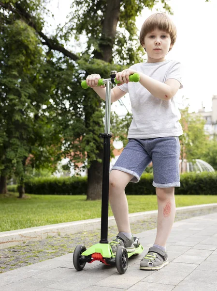 Üç tekerli scooter 'dan düştükten sonra bacakları yaralanan sevimli çocuk, yaklaş.