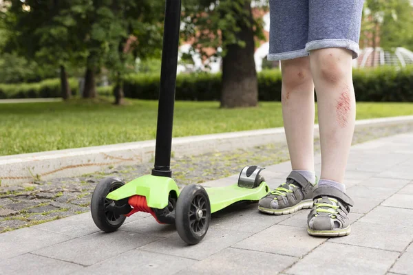 Yaralı erkek bacaklarına ve üç tekerlekli scooter 'a medyum görüntüsü ver, kapat.