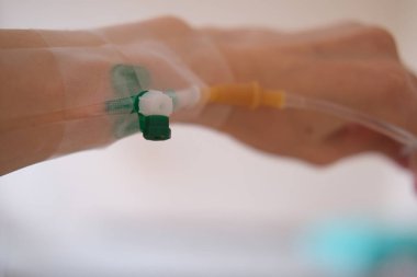 Hastanenin acil servisinde ciddi bir hasta için damar içi sıvı. Tıbbi tedavi acil durum kavramı.