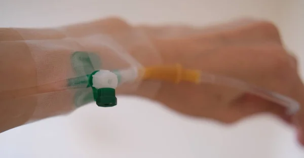 Líquido intravenoso para pacientes graves en la sala de urgencias del hospital. Tratamiento médico concepto de emergencia. — Foto de Stock
