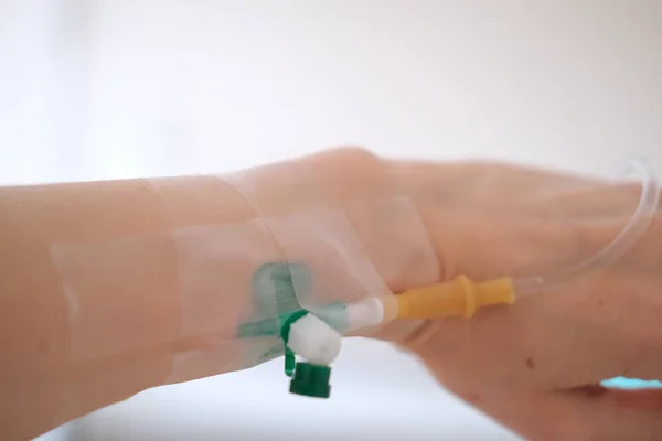 Líquido intravenoso para pacientes graves en la sala de urgencias del hospital. Tratamiento médico concepto de emergencia — Foto de Stock