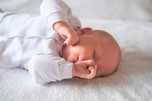 Portrait of a newborn baby with seborrhea sleeping on a white blanket. — Stock Photo, Image