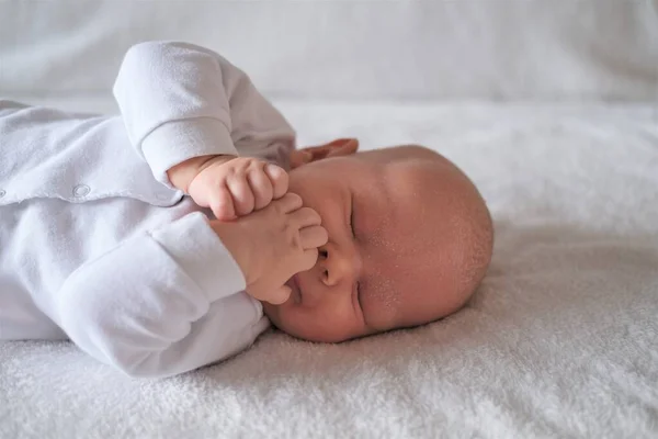 Portrait of a newborn baby with seborrhea sleeping on a white blanket. — Stock Photo, Image