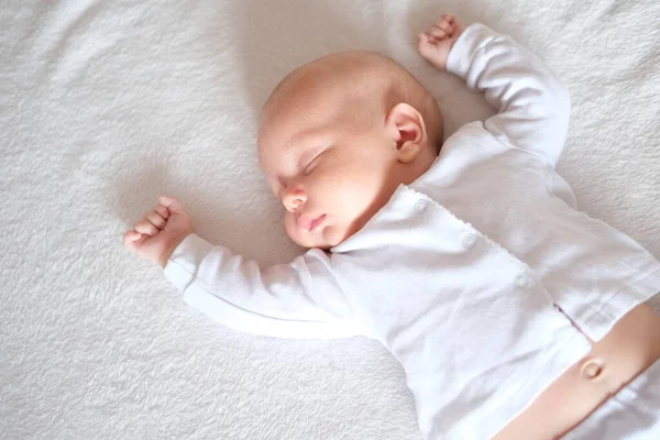 Portré egy újszülött baba seborrhea alszik egy fehér takaró. — Stock Fotó