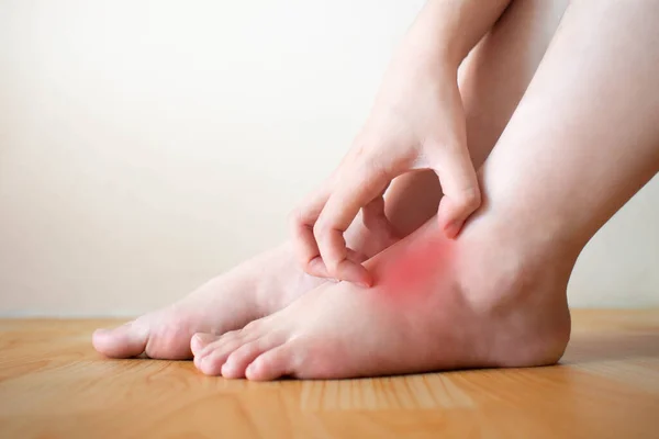 Ayaklarındaki kaşıntıyı kaşındıran genç bir kadın. Kaşınan derinin nedeni atlet ayağı (mantar enfeksiyonu), dermatit (egzama), sedef hastalığı veya böcek ısırıkları. Sağlık hizmeti konsepti. Kapat..