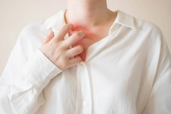 Jonge Vrouw Krabt Jeuk Haar Borst Nek Roodheid Uitslag Oorzaak — Stockfoto