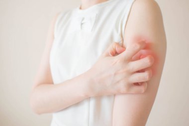 Beyaz arka planda kaşınmaktan kolları kaşınan genç bir kadın. Kaşınan derinin nedeni böcek ısırıkları, dermatit, gıda / ilaç alerjisi veya kuru cilt. Sağlık hizmeti konsepti. Kapat..