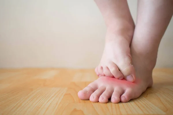 赤い発疹で足のかゆみを掻いている若い女性 かゆみの原因皮膚には 選手の足 真菌感染症 皮膚炎 または虫刺されが含まれます 健康管理 スペースのコピー — ストック写真