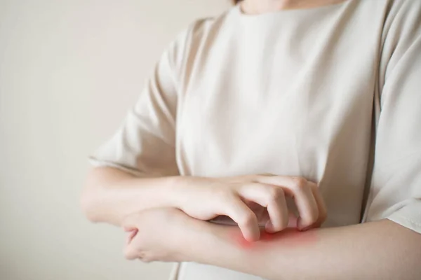Jonge Vrouw Die Haar Arm Krabt Van Jeuk Oorzaak Van — Stockfoto